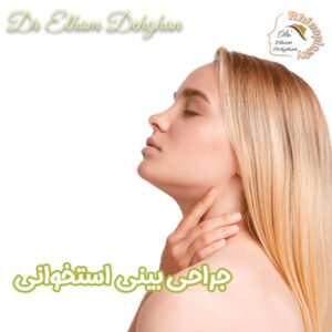 جراحی بینی استخوانی - دکتر الهام دهقان