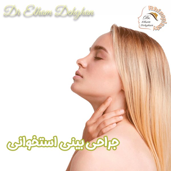 جراحی بینی استخوانی - دکتر الهام دهقان