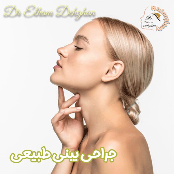 جراحی بینی طبیعی - دکتر الهام دهقان