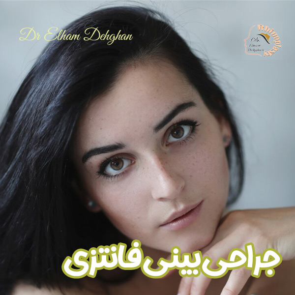 جراحی بینی فانتزی - دکتر الهام دهقان