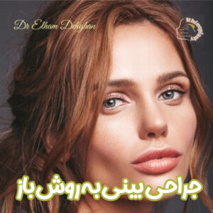 جراحی بینی به روش باز - دکتر الهام دهقان