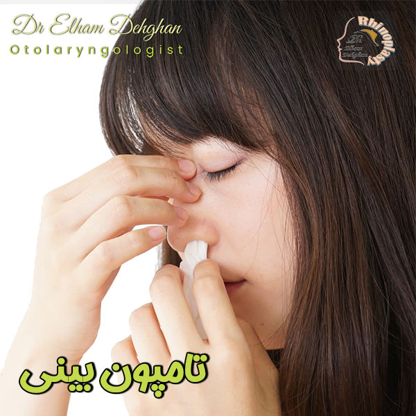 تامپون بینی - دکتر الهام دهقان