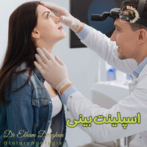 اسپلینت بینی - دکتر الهام دهقان