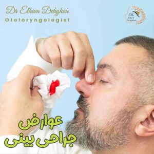 عوارض جراحی بینی - دکتر الهام دهقان