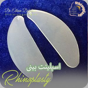 اسپلینت بینی | دکتر الهام دهفان