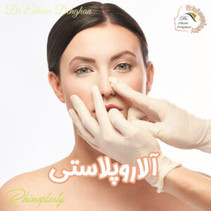 عمل کوچک کردن پره‌ های بینی- دکتر الهام دهقان