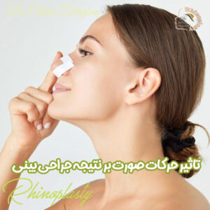 حرکات صورت بعد از عمل بینی - دکتر الهام دهقان