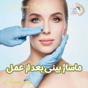 ماساژ بینی بعد از جراحی - دکتر الهام دهقان - drelhamdehghan.com