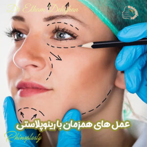 عمل‌های همزمان با جراحی بینی - دکتر الهام دهقان