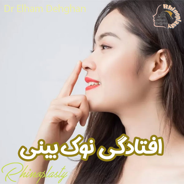 افتادگی نوک بینی - دکتر الهام دهقان