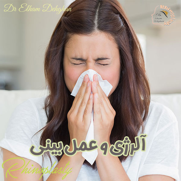 آلرژی و عمل بینی - دکتر الهام دهقان