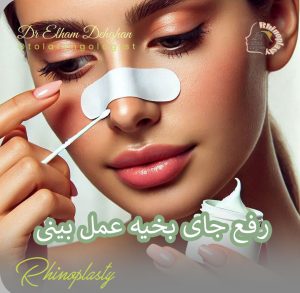 ترمیم جای زخم و بخیه عمل بینی _ دکتر الهام دهقان