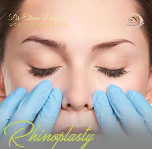 adhesion-after-rhinoplasty-drelhamdehghan-com