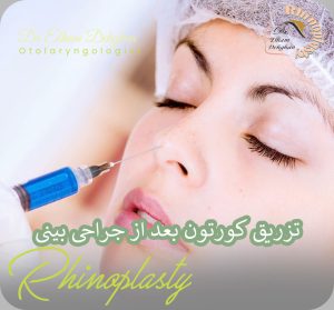 تزریق کورتون بعد از جراحی بینی | دکتر الهام دهقان