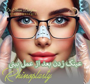 عینک زدن بعد از جراحی بینی دکتر الهان دهقان