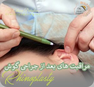 مراقبت های بعد از جراحی گوش | دکتر الهام دهقان