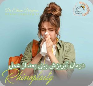 درمان آبریزش بینی بعد از عمل