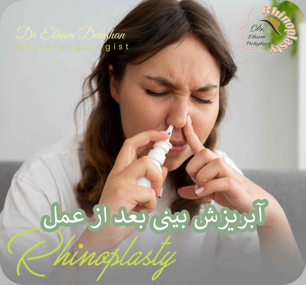 آبریزش بینی بعد از عمل - دکتر دهقان جراح بینی کرمان