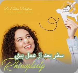 سفر بعد از عمل بینی - دکتر دهقان