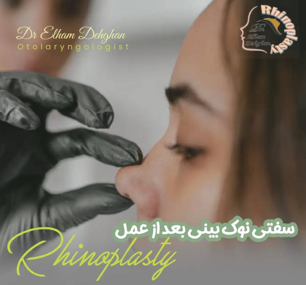 سفتی نوک بینی بعد از عمل