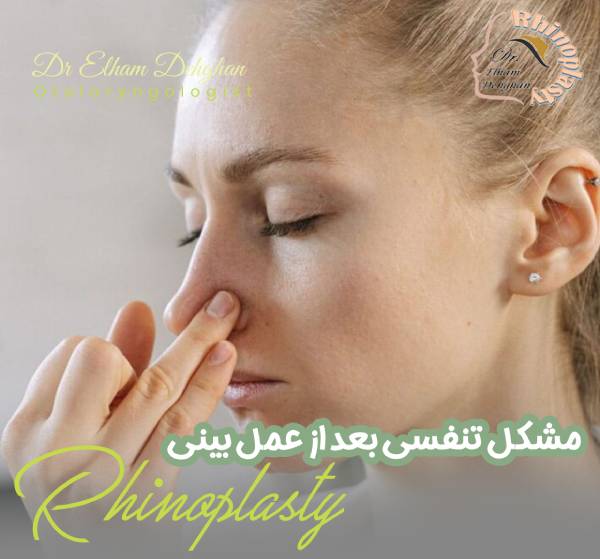 مشکل تنفسی بعد از عمل بینی