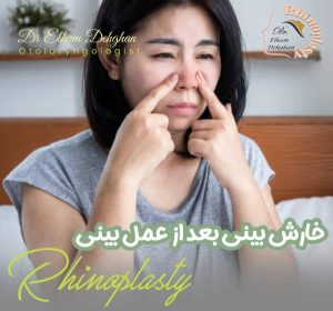 خارش بینی بعد از عمل