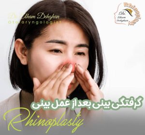 گرفتگی بینی بعد از عمل بینی