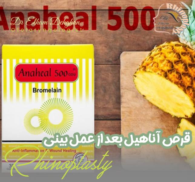قرص آناهیل بعد از عمل بینی