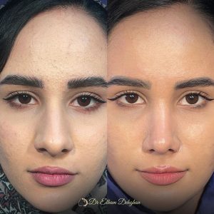 عکس عمل بینی در کرمان